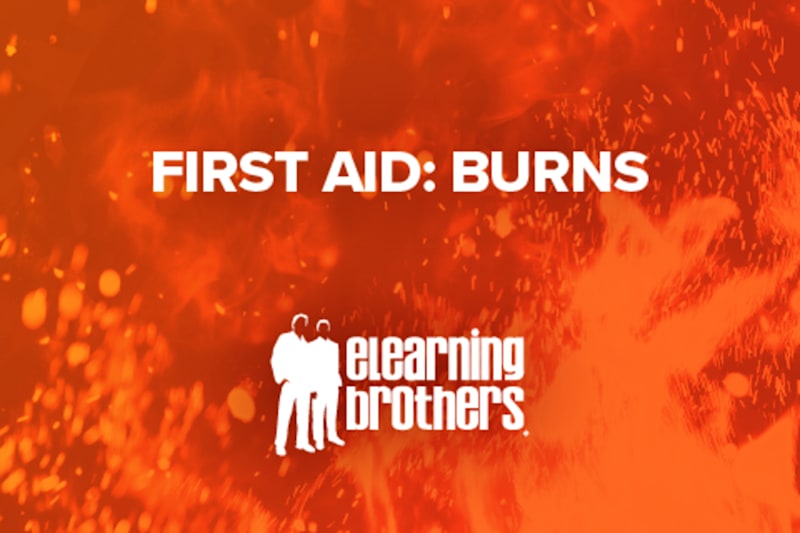 First Aid: Burns