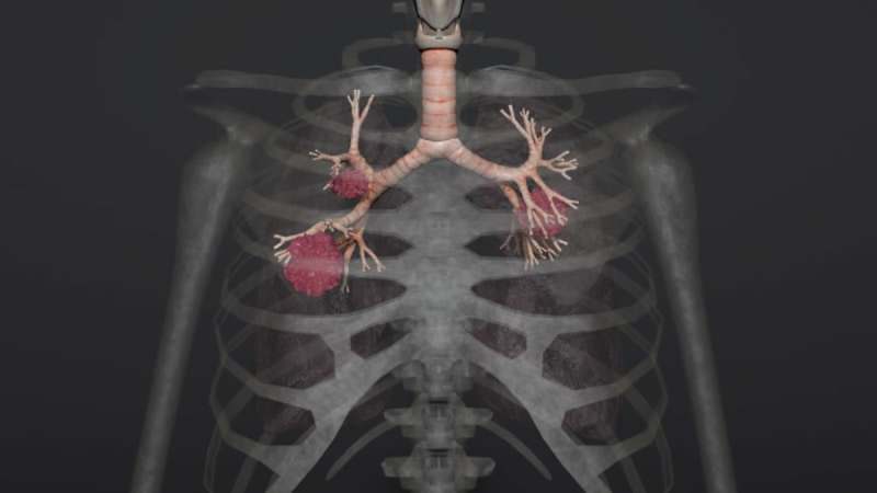 Asbestos Awareness